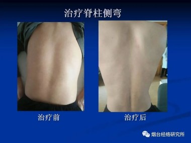 快讯：现代中医诊疗技术培训快讯!