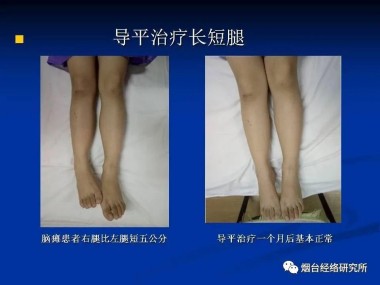 快讯：现代中医诊疗技术培训快讯!