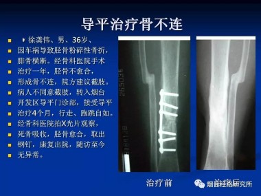 快讯：现代中医诊疗技术培训快讯!