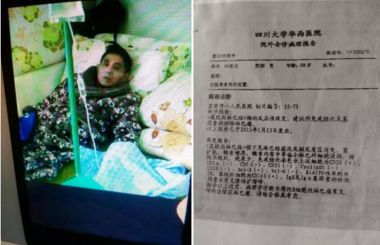 全蝎疗法发明人——孙纯孝