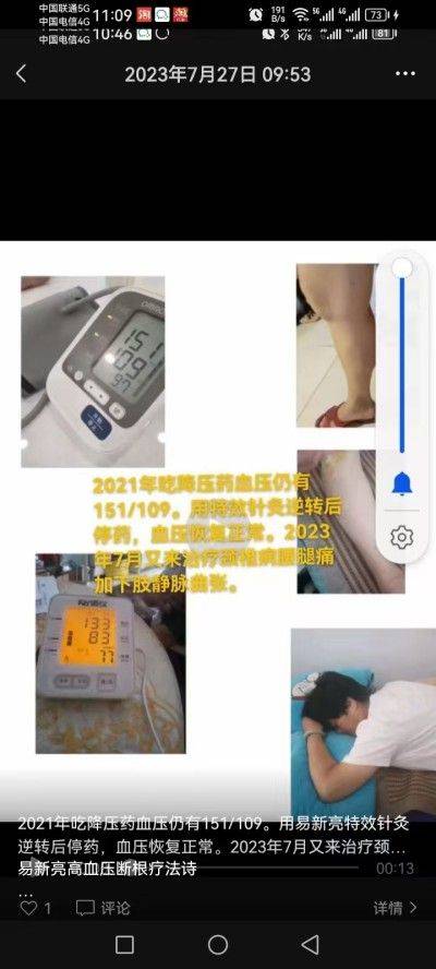 吃药打针降糖治不好糖尿病 易新亮灵氧细胞靶向针灸却能逆转三高断药