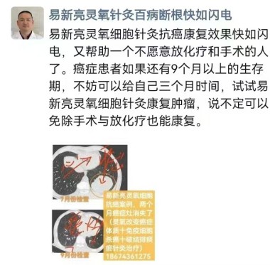 易新亮灵氧细胞穴位靶向疗法让细胞疗效倍增的奥秘