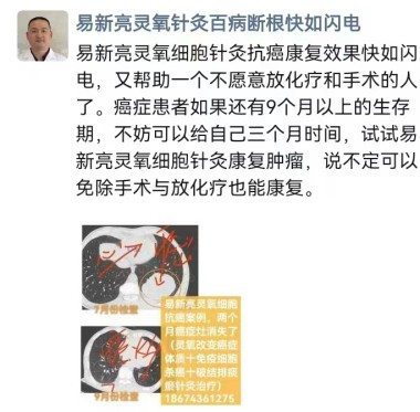 灵氧细胞穴位靶向疗法让细胞疗效倍增的奥秘--易新亮