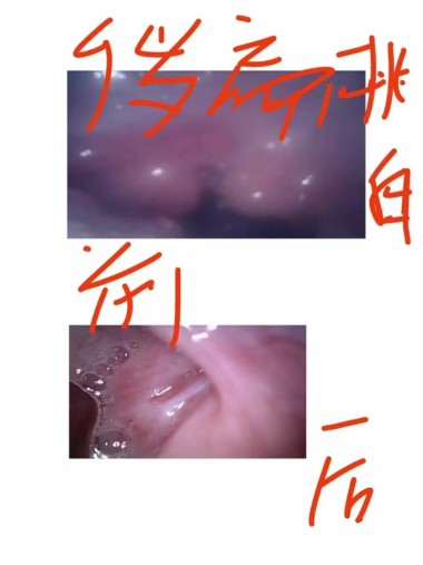 灵氧细胞穴位靶向疗法让细胞疗效倍增的奥秘--易新亮