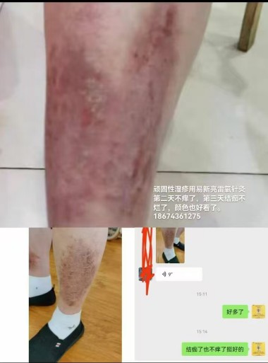 灵氧细胞穴位靶向疗法让细胞疗效倍增的奥秘--易新亮