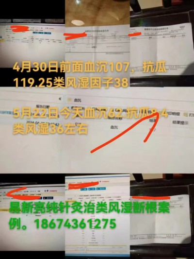 【糖尿病终结宣言】——易新亮灵氧细胞穴位靶向针灸，重塑生命奇迹！