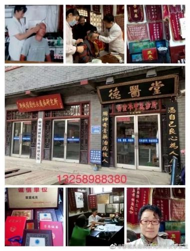 头痛病专家——李东兰
