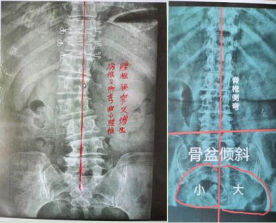贯彻落实两会精神 访新时代国医名师---杨宗仙