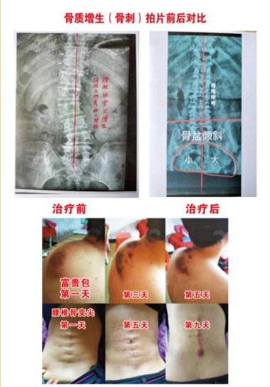 建国75周年特别报道 著名中医专家、国医名师---杨宗仙