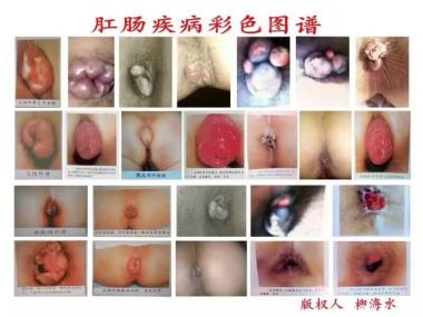 弘扬中医文化 传承国粹精神 中国当代名医——柳海水