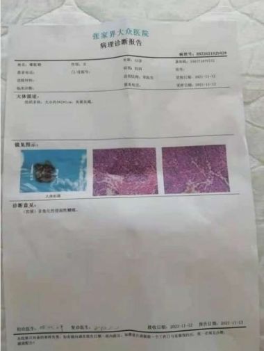 彰显中国榜样时代楷模中国著名针灸专家治疗肿瘤第一人——陈吉香