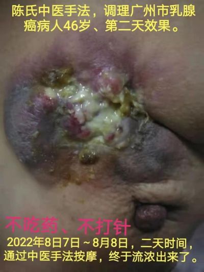 中国湘西苗医陈氏祖传秘方民间地产中草药技术---陈海峰
